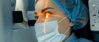 Laser eye surgery