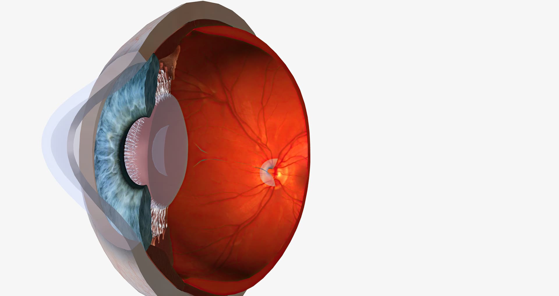 Lamellar Corneal Graft  